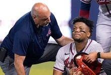 Ronald Acuna Out For Remainder of Season