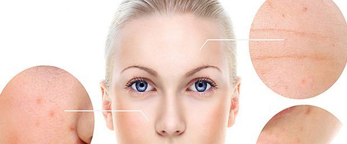 Tryvix anti wrinkle cream
